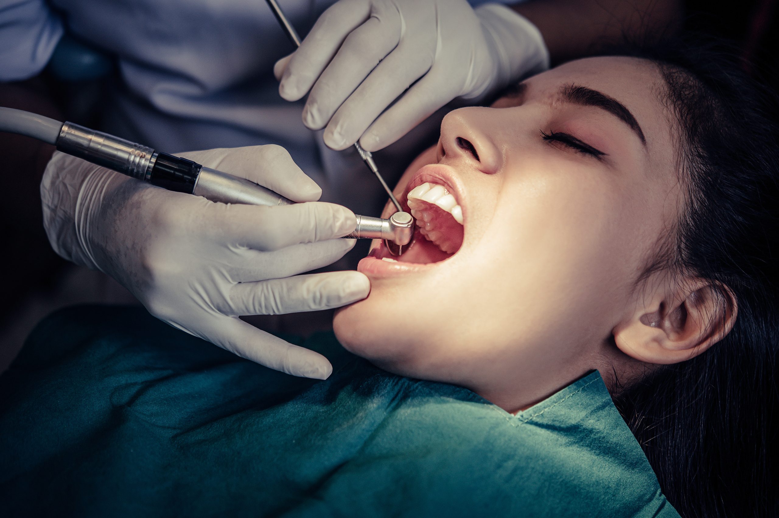 Why Professional Teeth Cleaning Goes Beyond Brushing at Home