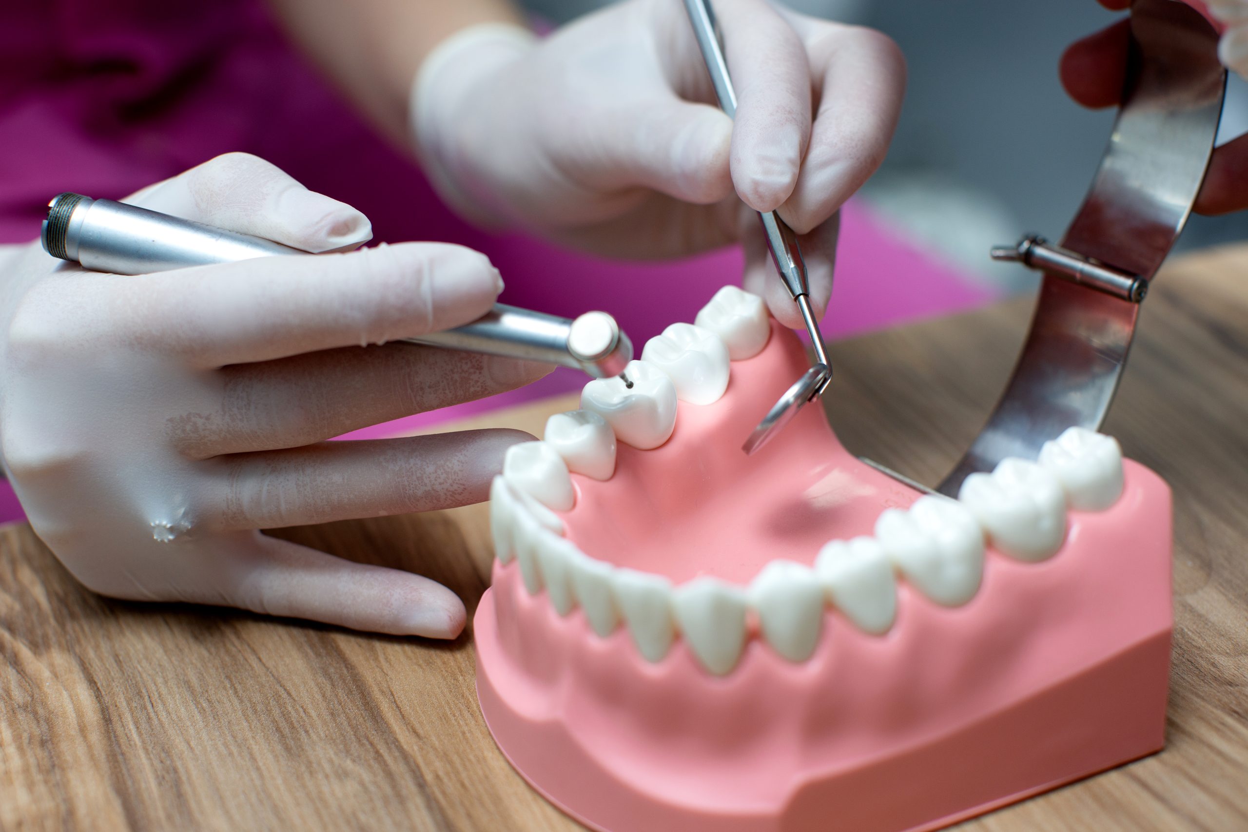 Types of Dental Bridges Which One Is Right for You